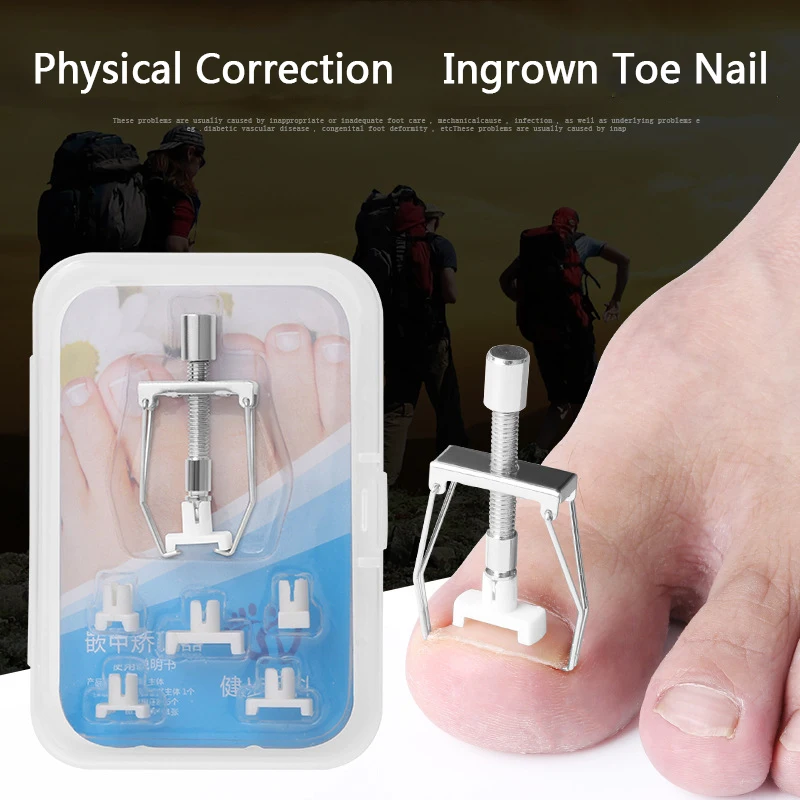 New Ingrown Toe Nail Recover Correction Tool Pedicure Toenail Fixer Foot Nail Care Tool Orthotic Nail Corrector Pedicure Tool