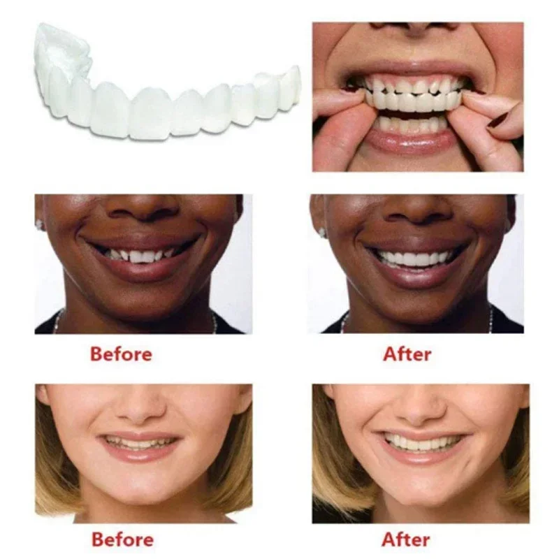 Sdotter New Fake Tooth Cover Perfect Fit Teeth Whitening Snap On Silicone Smile Veneers Teeth Dentaduras Flexibles Beauty Tool C