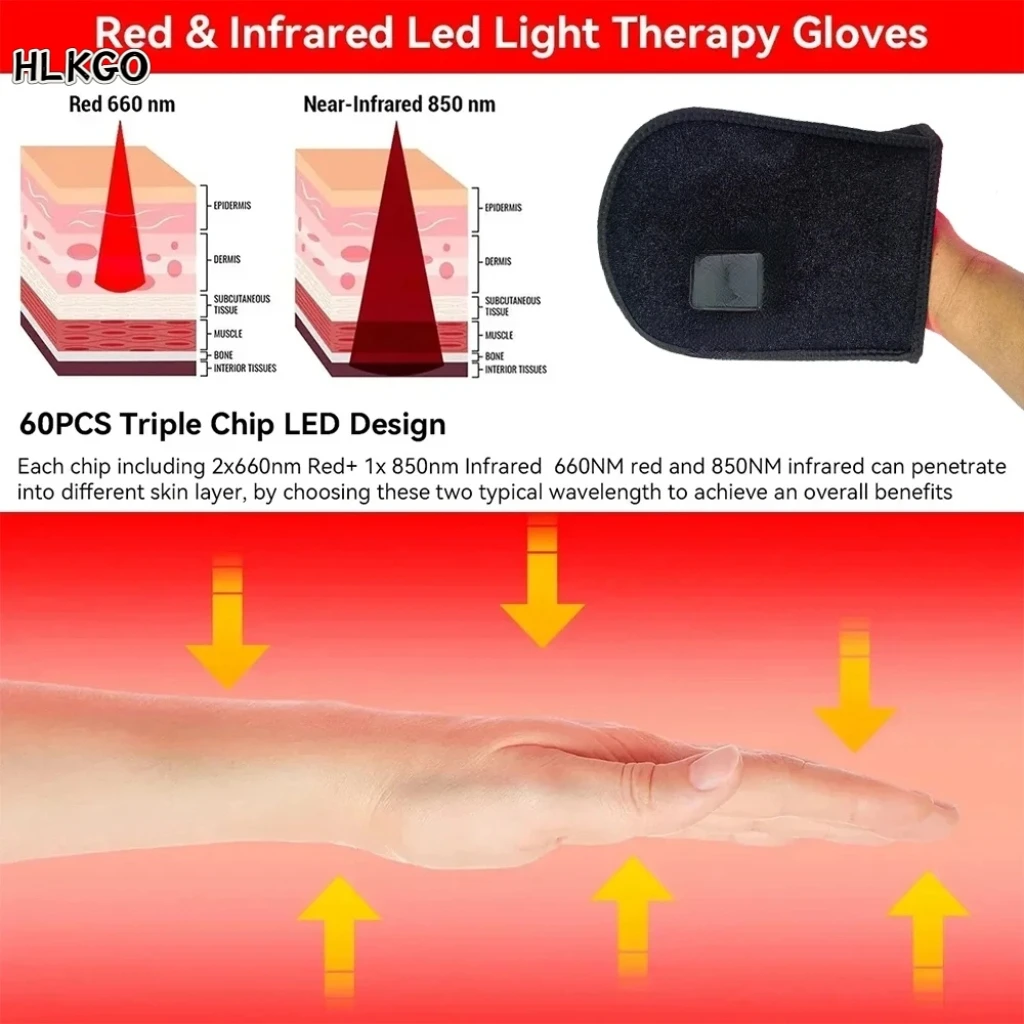 

Профессиональные перчатки для терапии красным светом 660 нм и 850 нм для облегчения боли в руках и расслабления мышц