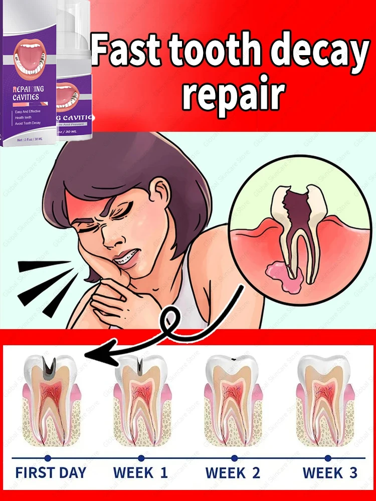 Tooth decay Repair Repair all cavities, protect teeth remove plaque stains Tooth decay repair teeth whitening Dental