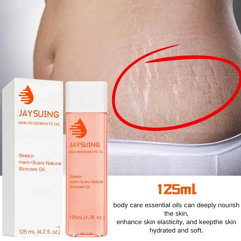 

Body Skin Care Essential Oil Firming Body Fades Stretch Fades Improves Skin Body Uneven Skin Facial Tone Oil Tattoos Marks