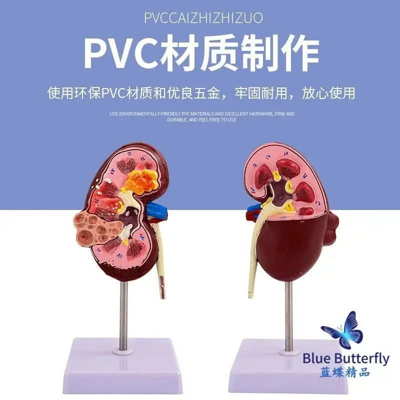An Enlarged Anatomical Model Of The Human Kidney, A Cross-sectional Anatomical Model Of The Kidney, And A Structural Model