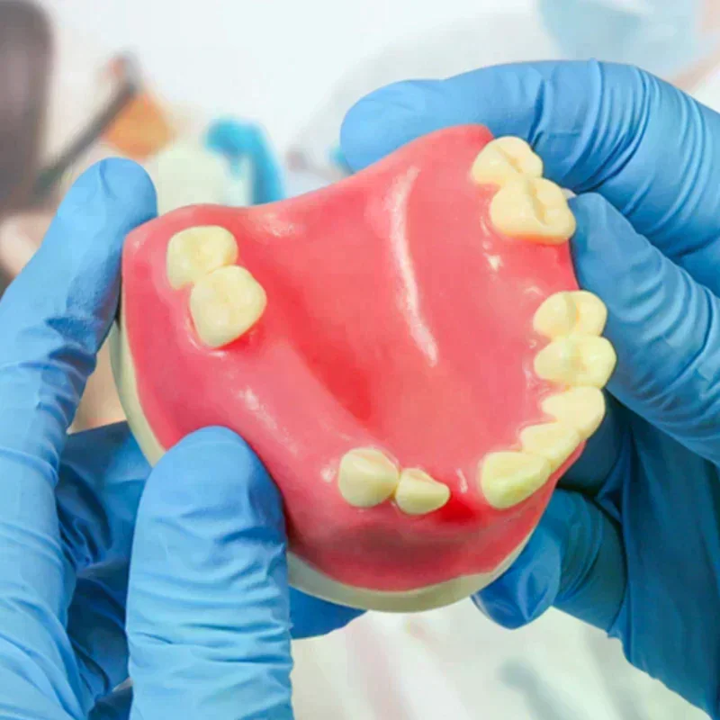 

Teeth Loss Model Dental Implant Student Teaching Training Aid Practice Model Upper Jaw Lift Implants Restoration Model Lab