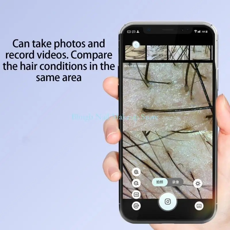 28TA محلل جلد فروة الرأس متعدد الوظائف مع اتصال واي فاي كاميرا عالية الوضوح للعناية بفروة الرأس تكبير 50x-200x #4