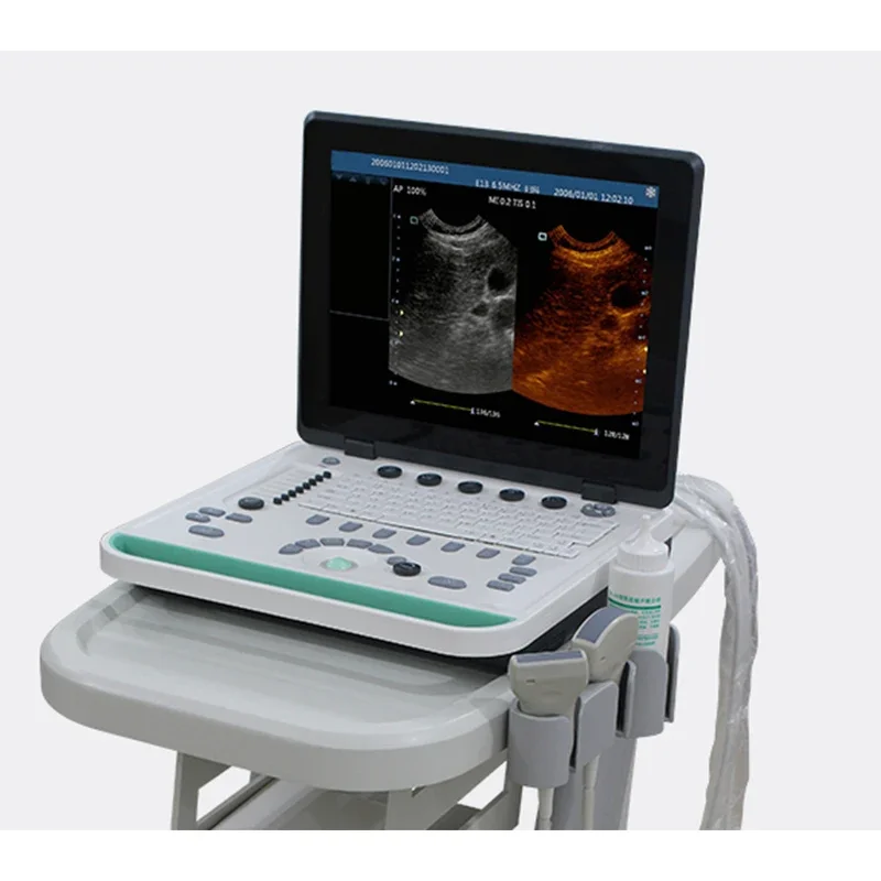 15 INCH fast delivery warranty laptop Obstetrics 3D ultrasound cheap price