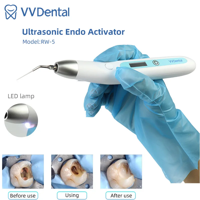 VV Dental Dental Sonic Endo Irrigator Activator for Root Canal Cleaning And Calcified Stain Removal Dental Endodontic Materials