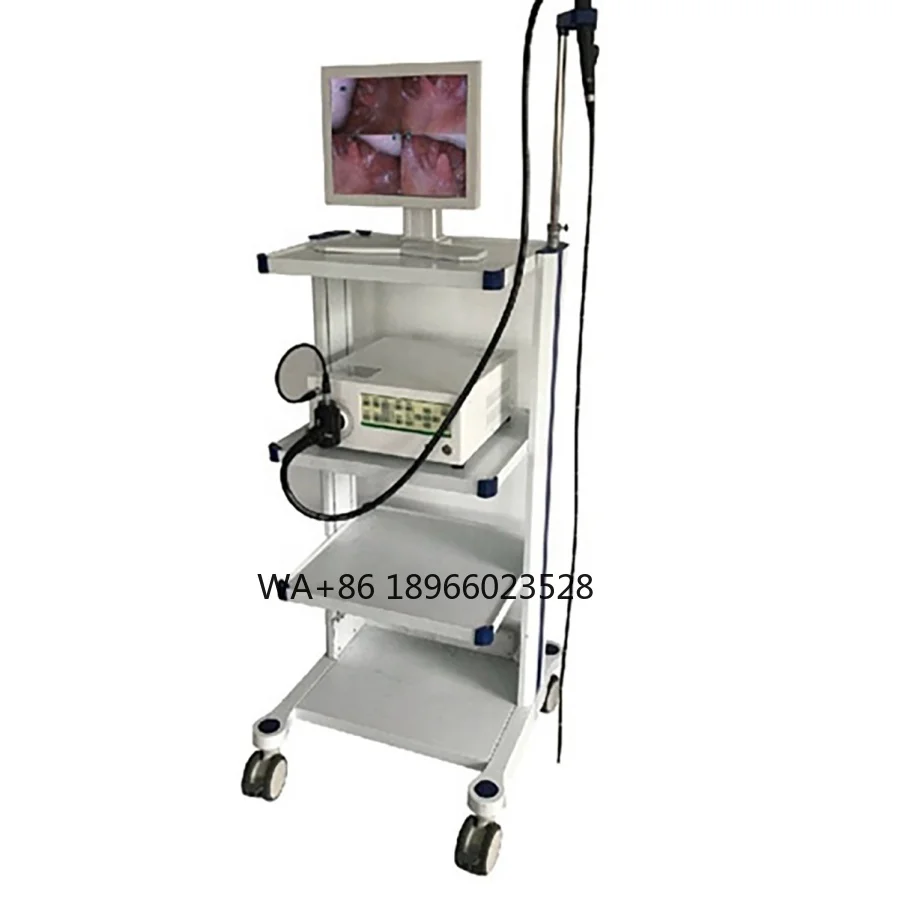 Hysteroscopy Tower Complete Set Endoscopy Equipment gynecological Medical Diagnostic Office Hysteroscopy Set MSLSY09