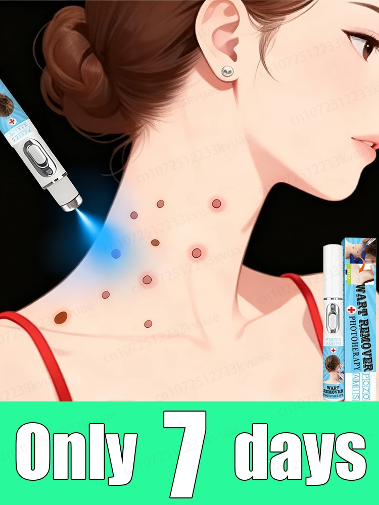 

Лазерное быстрое удаление бородавок 3-го поколения