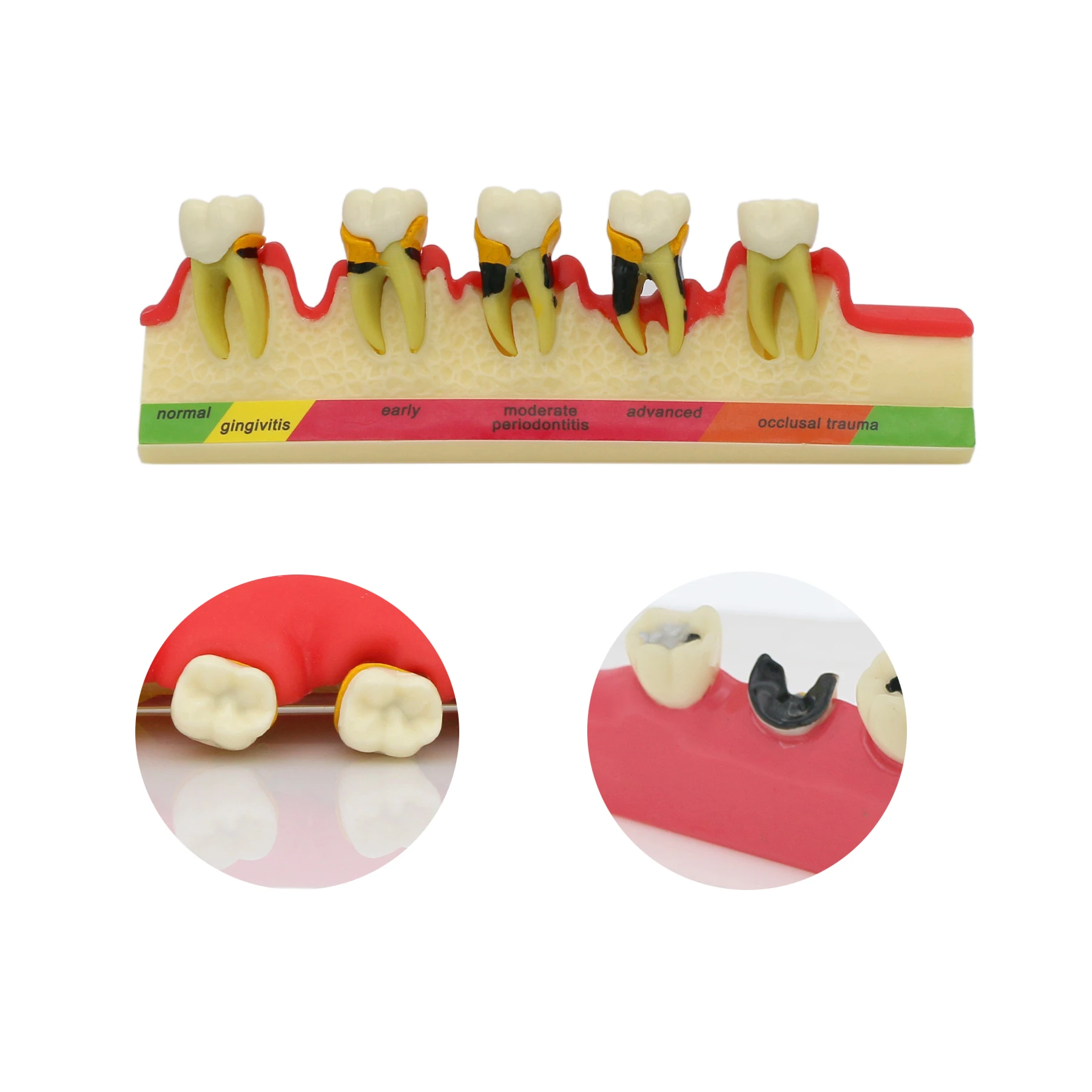 Dental 1:1 Typodont Orthodontic Teeth Model Gingiva Visible Anatomical Demonstration Teaching Study