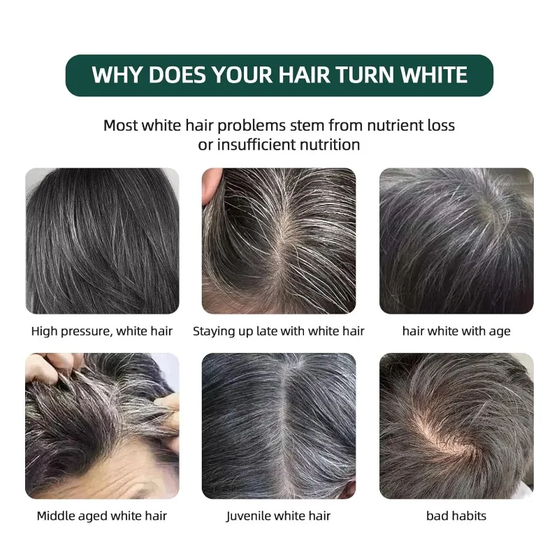 SEVEN GREEN Natural Usman Grass Shampoo Bar,Effectively Cleansing Scalp Strengthening Hair Roots Reducing Hair Loss Plant Soap