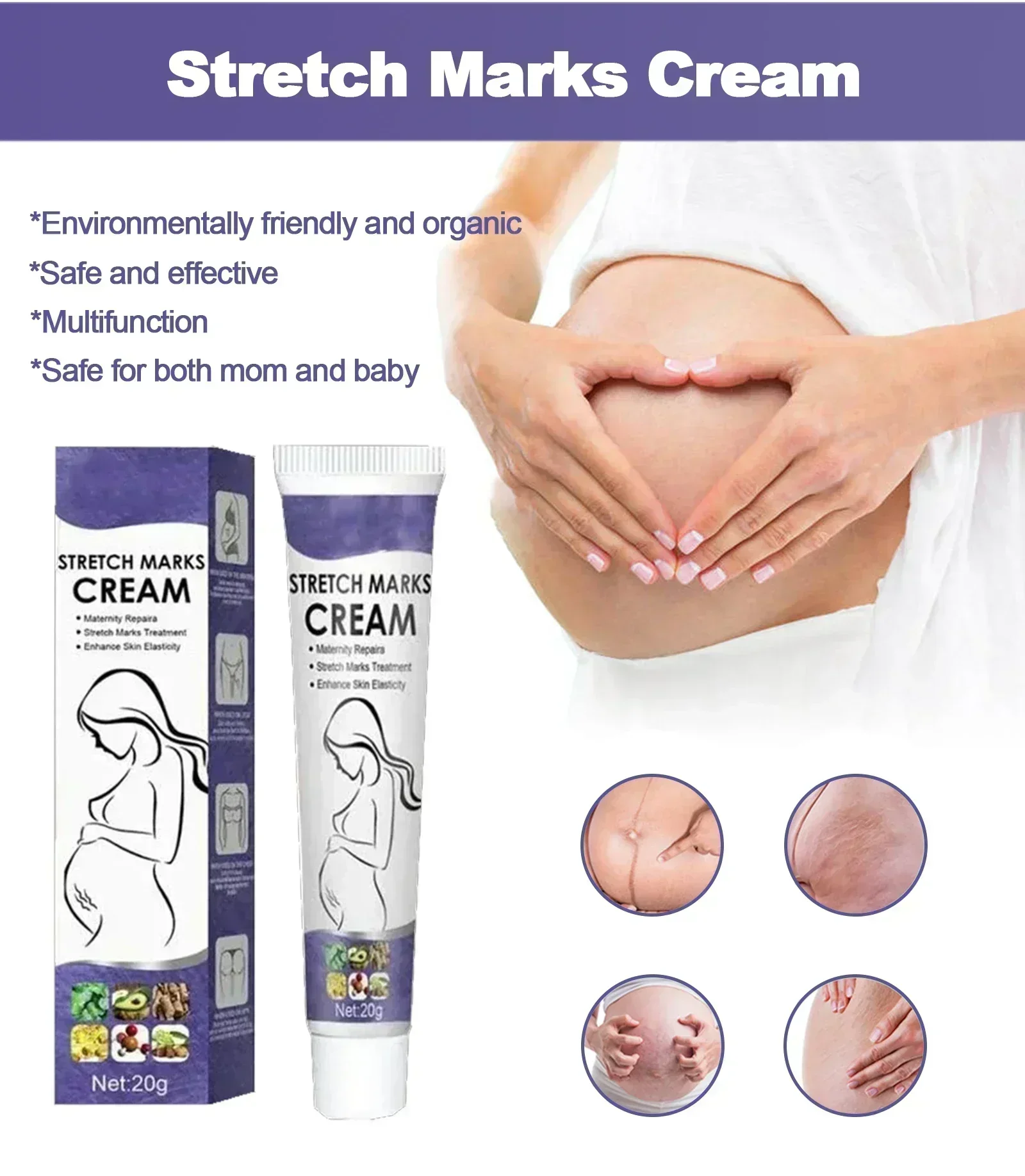 

Stretch Mark Remover Permanent Stretch Mark Removerstretch marks remove scars Cream Eliminate Red White OldStretch Marks