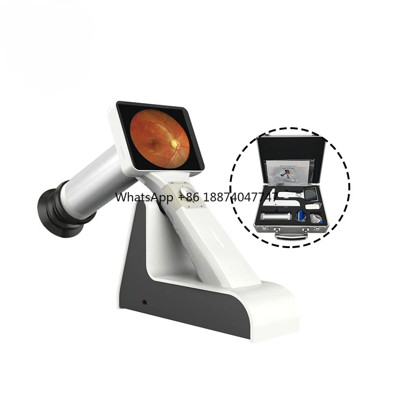 Ophthalmic Retinal  non-mydriatic Digital Handheld Ophthalmology Portable eye fundus