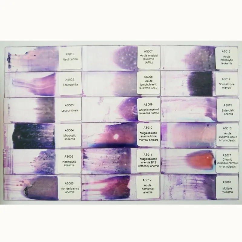 

Microscope Prepared Slides Blood Human Pathology Slides Hematology Pathology Smear Prepared Slides Medical Science Pathology