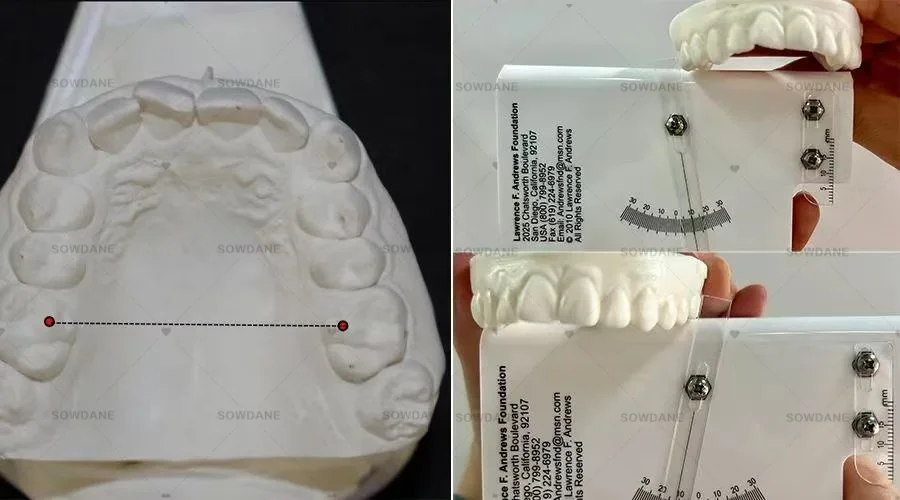 6 Six Elements Dental Measuring Ruler Molar Torque Caliper Measure Device Dental Combined Protractor Sliding Positioning Ruler