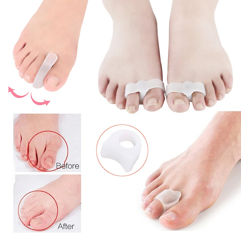 Toe Corrector for Hallux Valgus Gel Foot Care Toe Separator Little Finger Protector Bunion Straightener Silicone Insert Shoe Pad