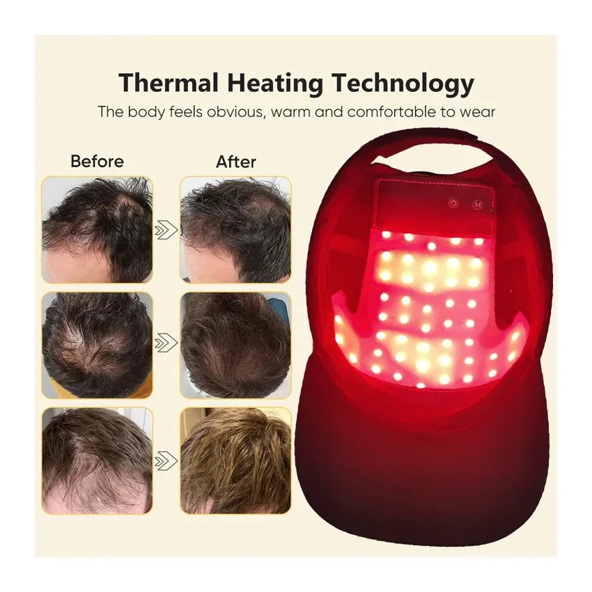 Red&Blue Light Therapy  Cap Hair Fast Growth Red & Infrared Light Therapy Device For Hair Loss Treatment With USB Charging