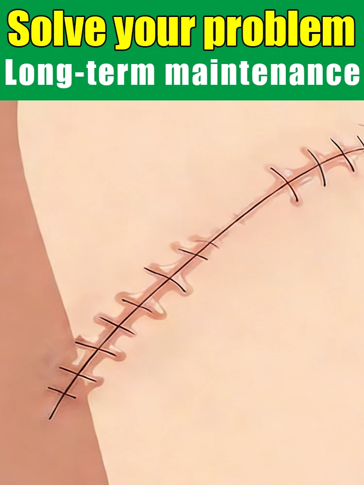 

Популярный выбор: лазер с синим светом, новинка, без вреда для кожи.