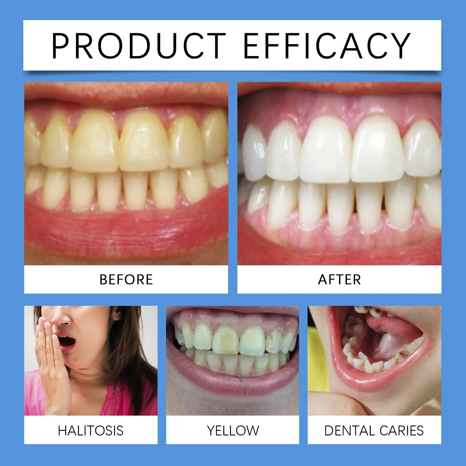 شرائط العناية بالأسنان النعناع ينعش التنفس يزيل البقع البلاك الأسنان الصفراء تنظيف عميق العناية بالأسنان شرائط الأسنان 7 قطعة/صندوق 2026 #5