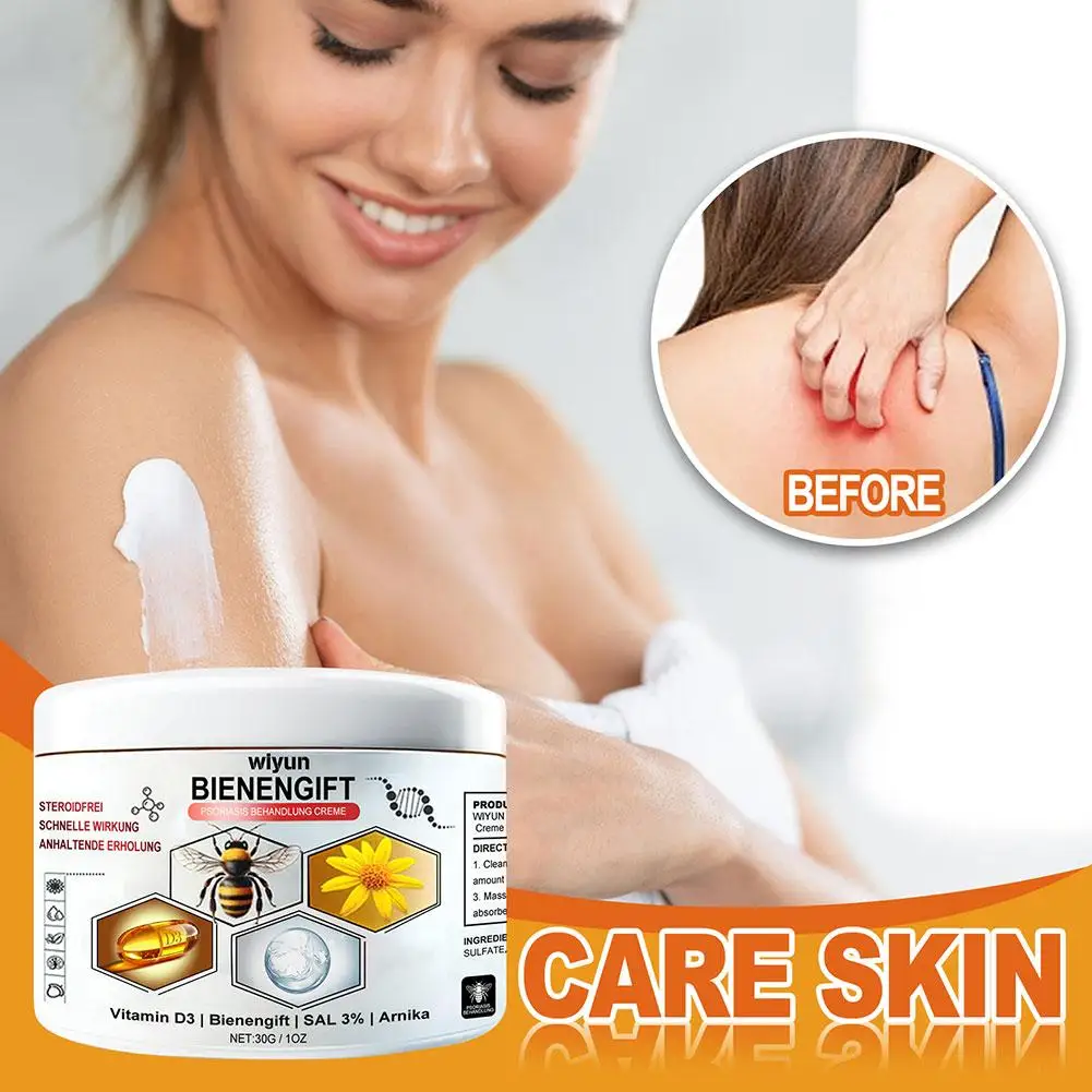 Crema para el cuidado de las articulaciones Venoms de abeja, 30g, alivia el dolor de las articulaciones cervicales, tratamientos de masaje, crema para la salud de los huesos, herramientas para el cuidado del cuerpo