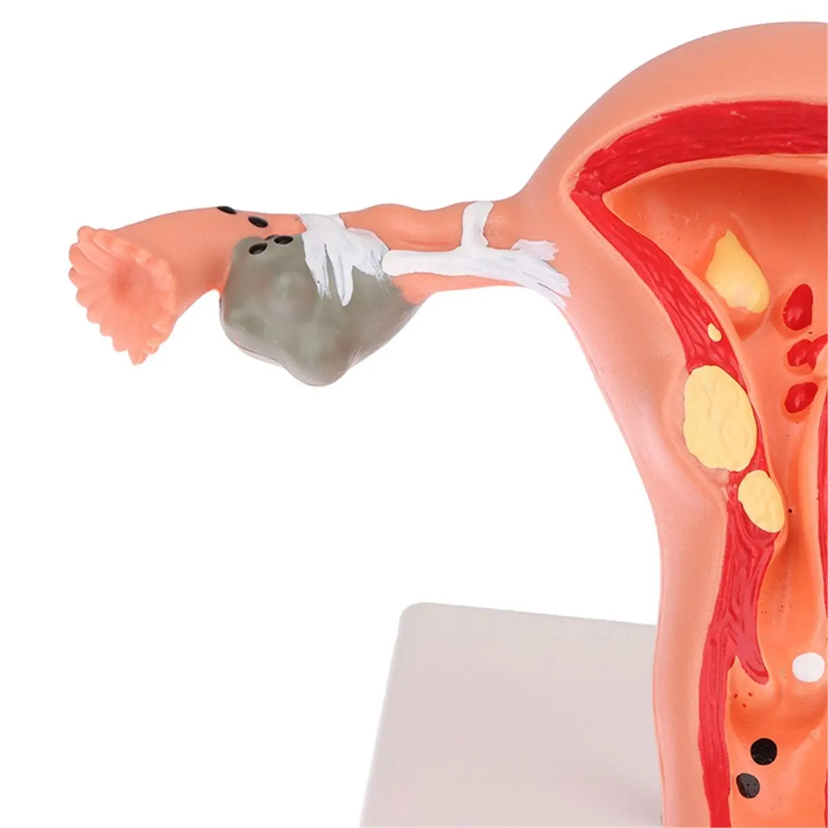 (A02R] Female Uterine Model, Anatomy of Reproductive Organ Structure, Human Teaching Pathology, Ovarian Hospital, School Use