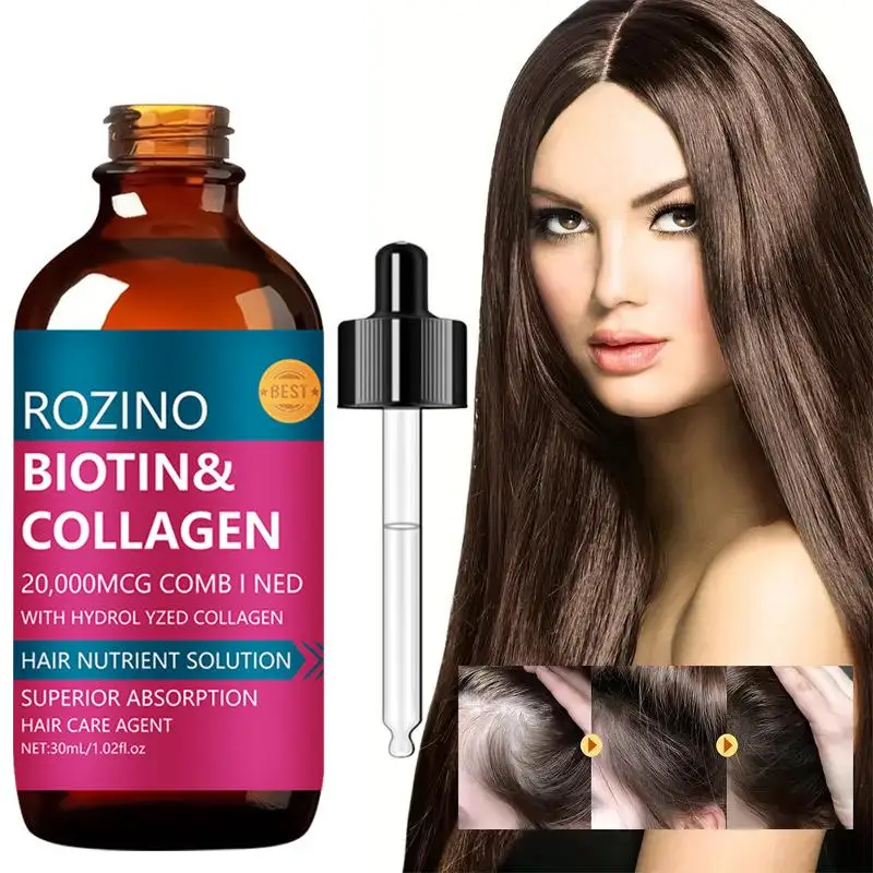 ビオチンヘアシャンプー増毛強化根オイルコントロールヘアボリュームシャンプービオチンヘア血清 30 ミリリットル/100 グラムヘアケア