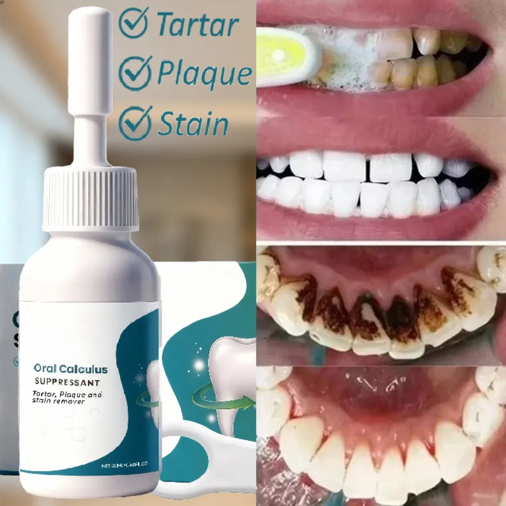 

Горячий FagOral ингибитор налета embaliAdsorbs Bad Breath Удаление желтых зубов Сильная очистка пятен на зубах 뷰Oral Care