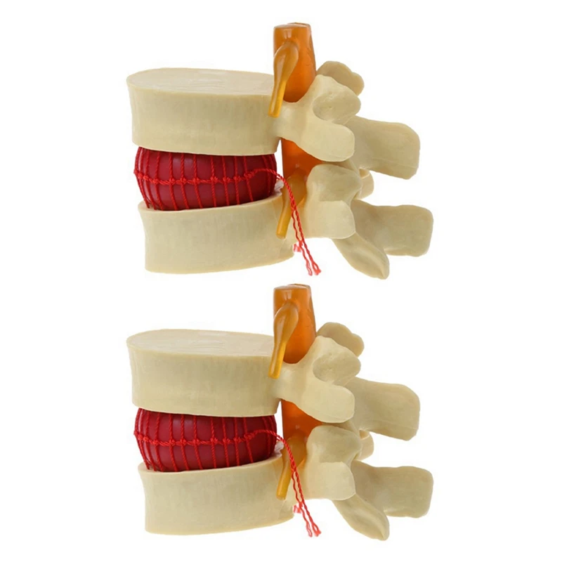 2X Lumbar Vertebrae Model Anatomical Spine Lumbar Disc Herniation Anatomy Teaching Tool Lumbar Vertebrae Model