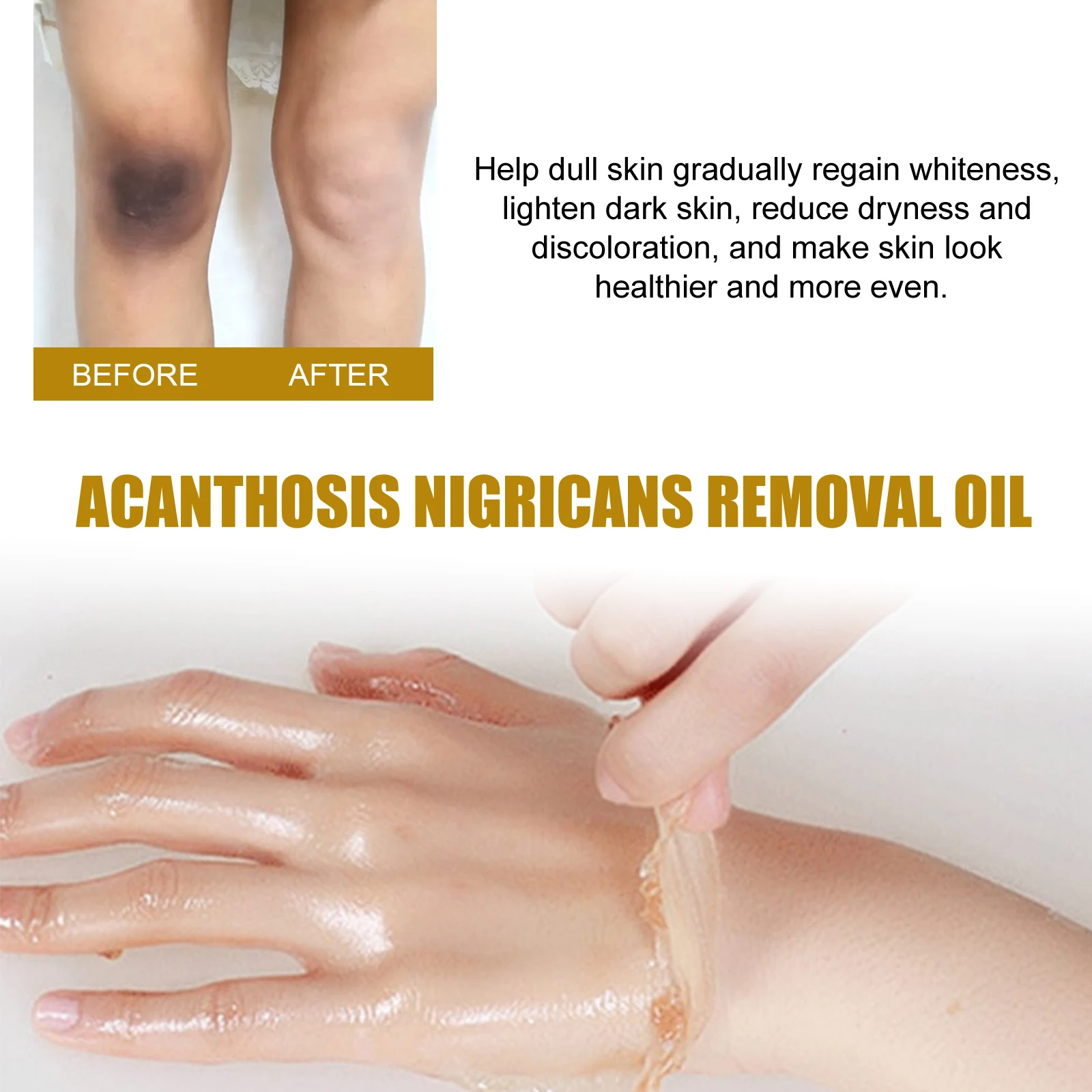 Black Acanthopanax Exfoliating Oil, Exfoliating Light Black Brightening Skin Tone Beauty Oil