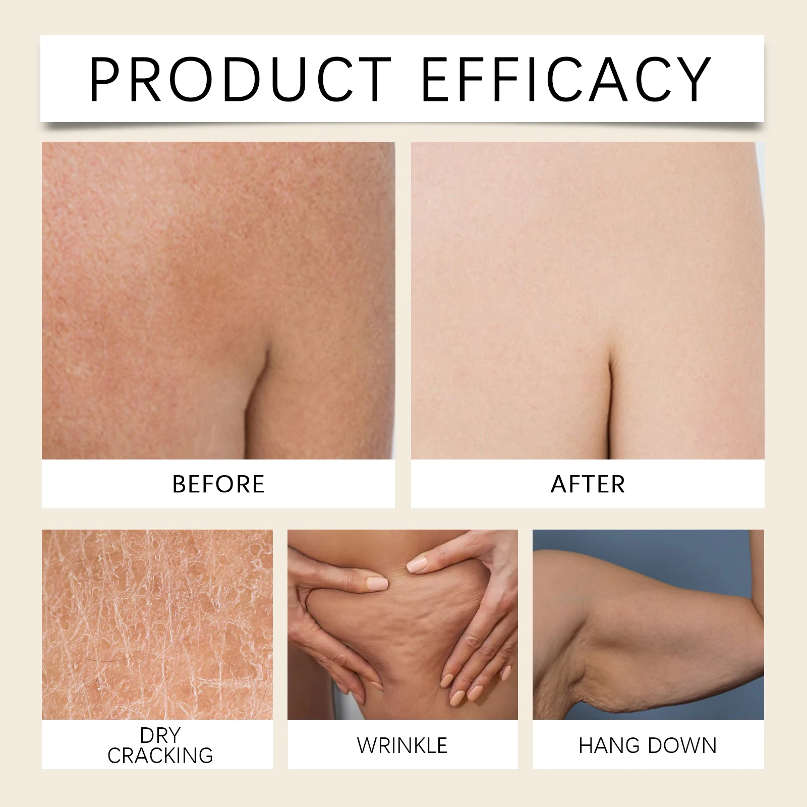 주름 개선 보습 바디 크림, 주름 완화, 잔주름 개선, 보습, 진정, 재생, 영양 공급, 광채 피부 관리