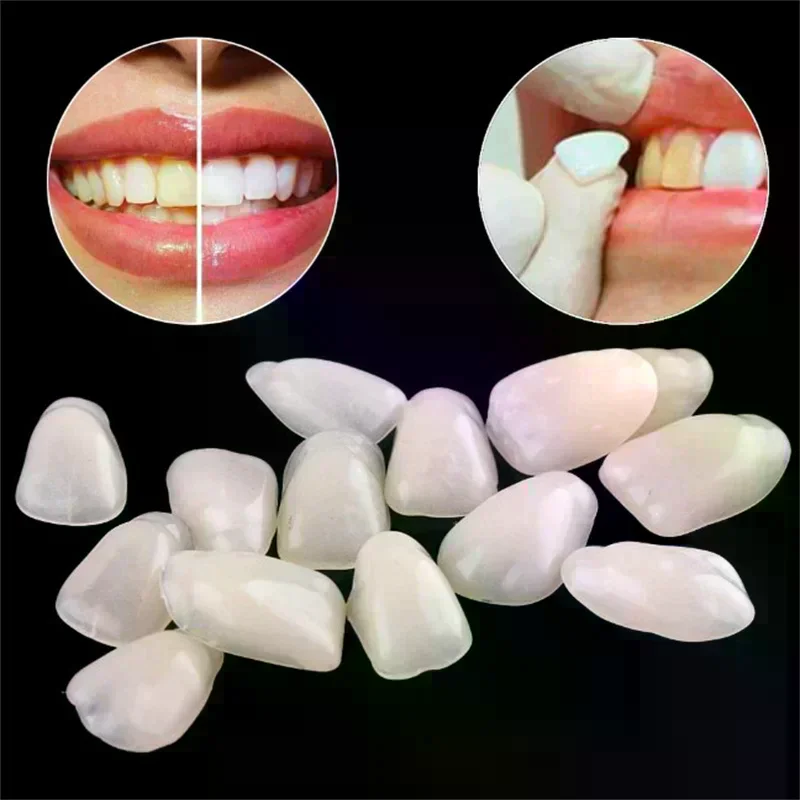 Dental Veneer Temporary Teeth Whitening Dental Membrane Teeth with Ultra Thin Whitening Veneer Resin Teeth on the Front