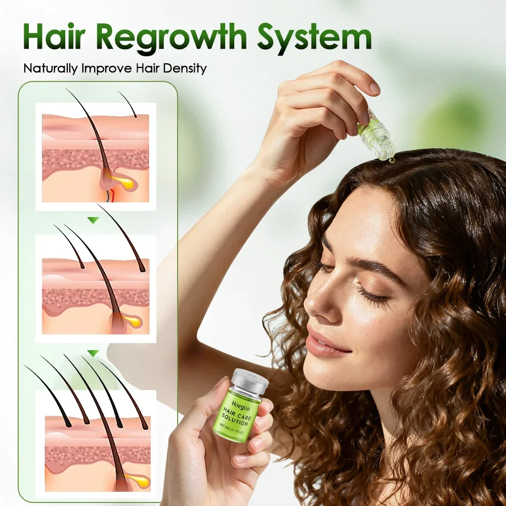 Thumbnail 3 - #35 Latest Hair Loss Treatments Offers