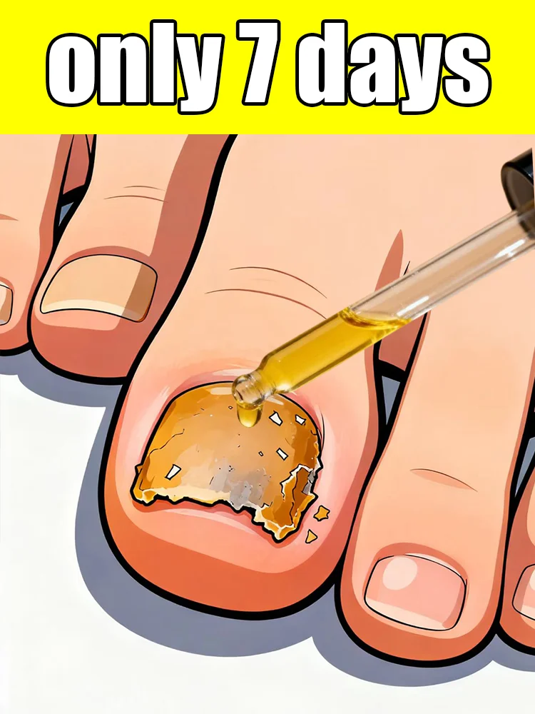 

Repair discolored nails and maintain foot care