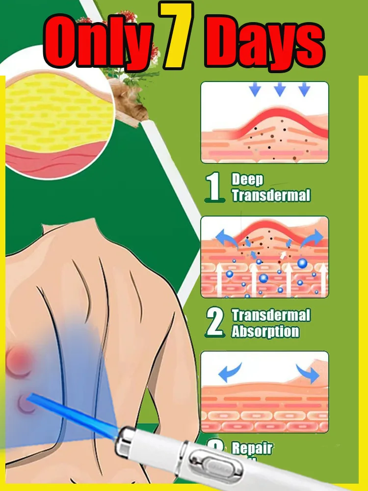

unisx Multi functional blue light laser pen solves skin problems on the body, no longer worrying about skin issues