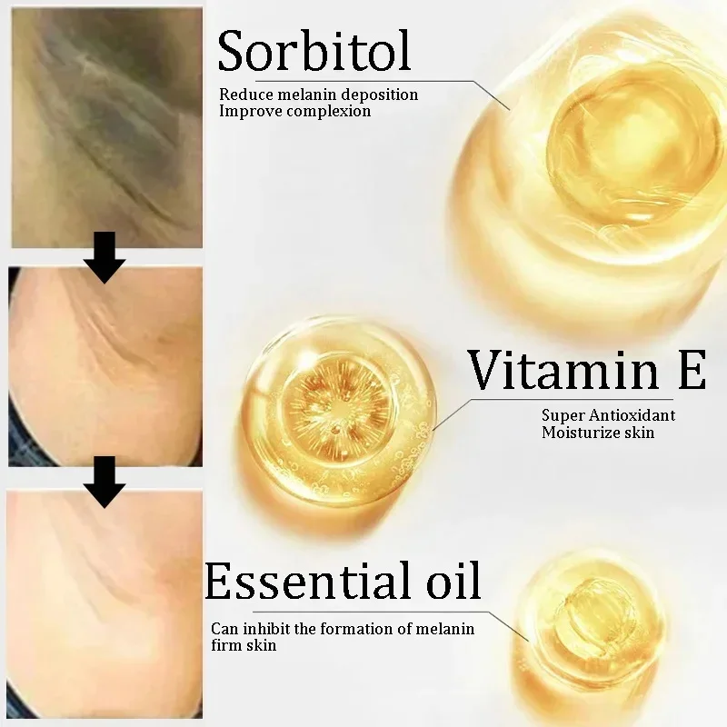 صابون تبييض الجسم تحت الإبط صابون تبييض الركبة إزالة جلد الدجاج إزالة البقع الداكنة الجلد الميت ترطيب سطع العناية بالجسم #1