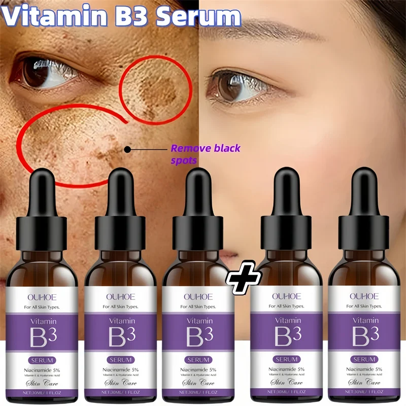 

Vitamin B3 Facial Serum Niacinamide 5% Vitanin E Hyakuronic Acid Remove Black Spots Freckle Fade Melanin Pigmentation Brighten