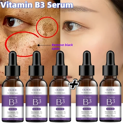 Suero Facial con vitamina B3, niacinamida, 5% Vitanin E, ácido hipurónico, elimina las manchas negras, pecas, decoloración, melanina, pigmentación, brillo