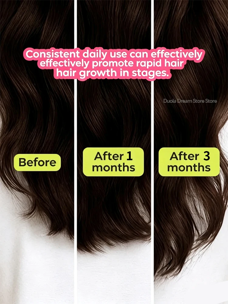 Alopecia Serum, Anti Hair Break Thicken Hair, Scalp Repair Loss Treatment for Men Women