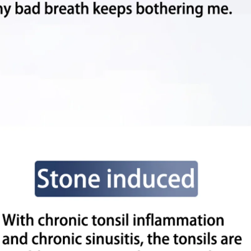 Electric Tonsil Stone Remover Tonsil Stone Removal Kit Vacuum With Irrigation Syringe Instant Suction Tonsil Stone Removal