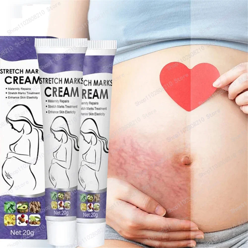 

Cream For Pregnancy Stretch Marks Removal Eliminate Red White Old Stretch Marks Oil