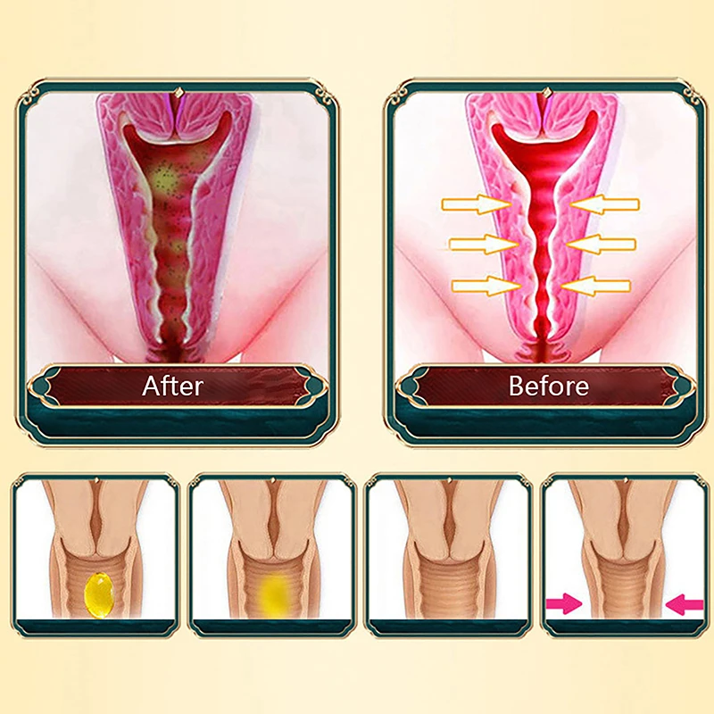 1 Capsule Vaginal Tightening Vagina Shrinking Moisturizing Hygiene Repair Firming Pill Women Postpartum Recovery Private Care