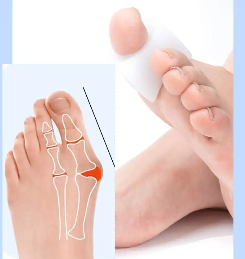 

1/50Pairs Silicone Toe Corrector Gel Protector Finger Separator Orthopedic Products Hallux Valgus Pedicure Foot Care Hammer
