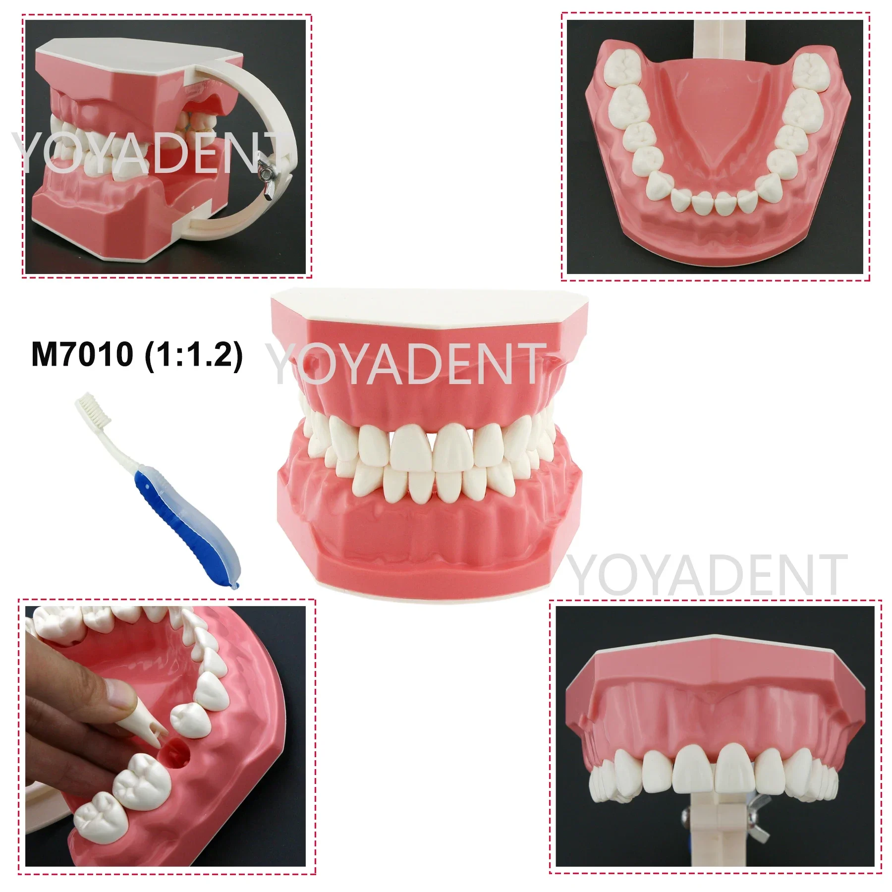 Dental Model Dentistry Teaching Standard Model Detachable Orthodontic/Periodontitis Pathological Model Multiple Types