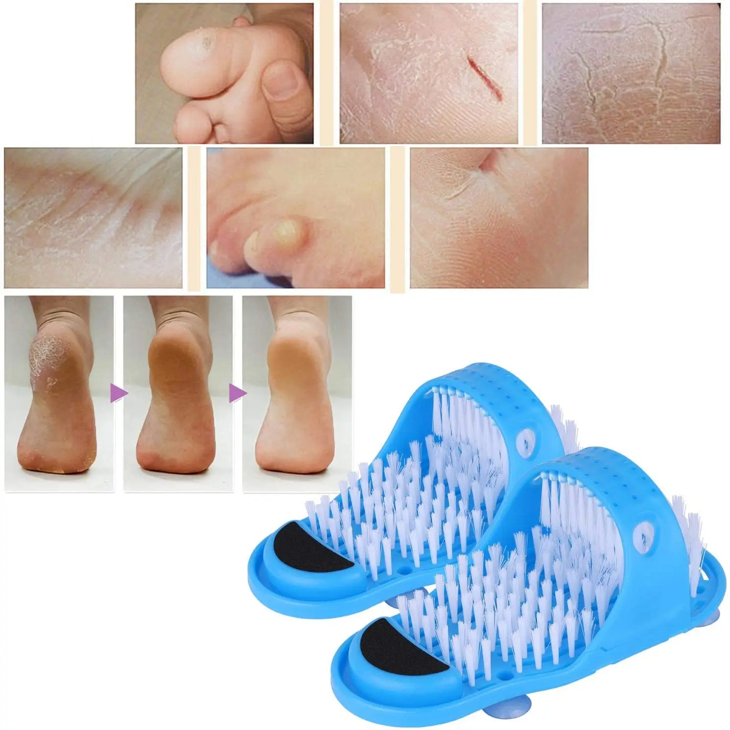 Plastic Bath Shower Feet Massage Slippers Bath Shoes Brush Pumice Stone Foot Remove Dead Skin Foot Care Tool Foot massager