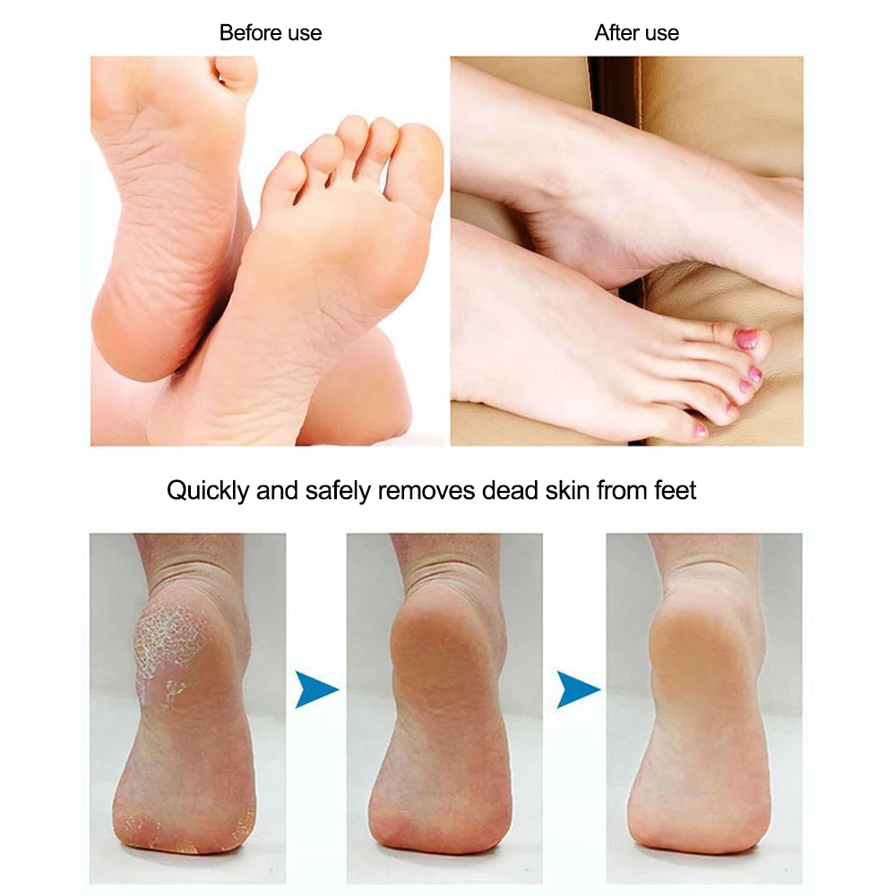 Máquina de cuidados com os pés Pé Hard Dry Dead Cutícula Removedor de pele Pedicure Cuidados Ferramentas Remoção Foot Grinding File Skin Foot Tool 1PCS