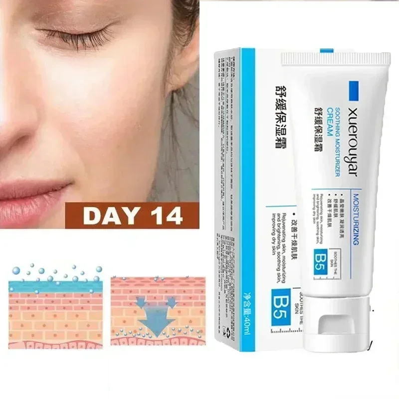 7 Day Repair Facial Redness Cream Soothing Redness Repair Skin Rosacea Red Blood Improve Sensitive Skin CareKorean Cosmetic