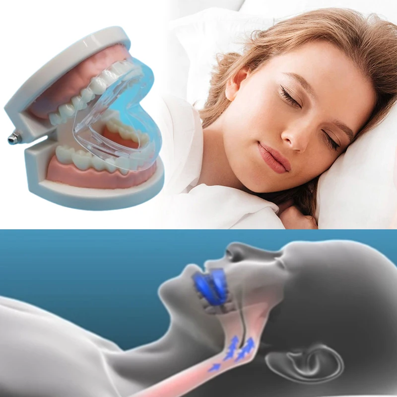 Adult Anti-snoring Kit Silicone Mouthpiece Sleep Teeth Grinding Mouth Guard Adjustable With Storage Case Bruxism Dental Braces