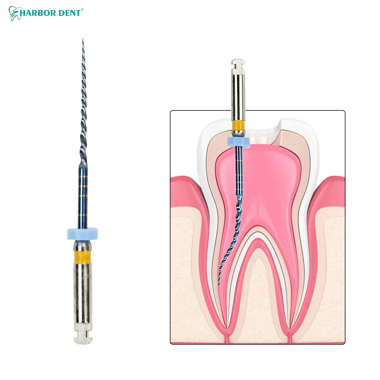 6pcs/Box Dental Root Canal File Endo Rotary Files Endodontic Files 25mm Nickel Can Bend for Preparing Root Canal Treatment