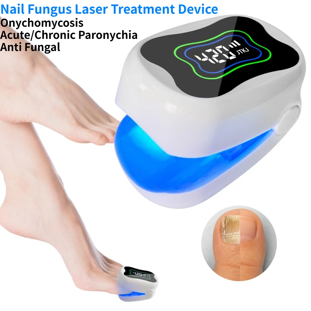 

Frovab Nail Fungus Laser Treatment Device LED Light Therapy for Onychomycosis Toenail Anti Fungal Effectively Remove Home Use