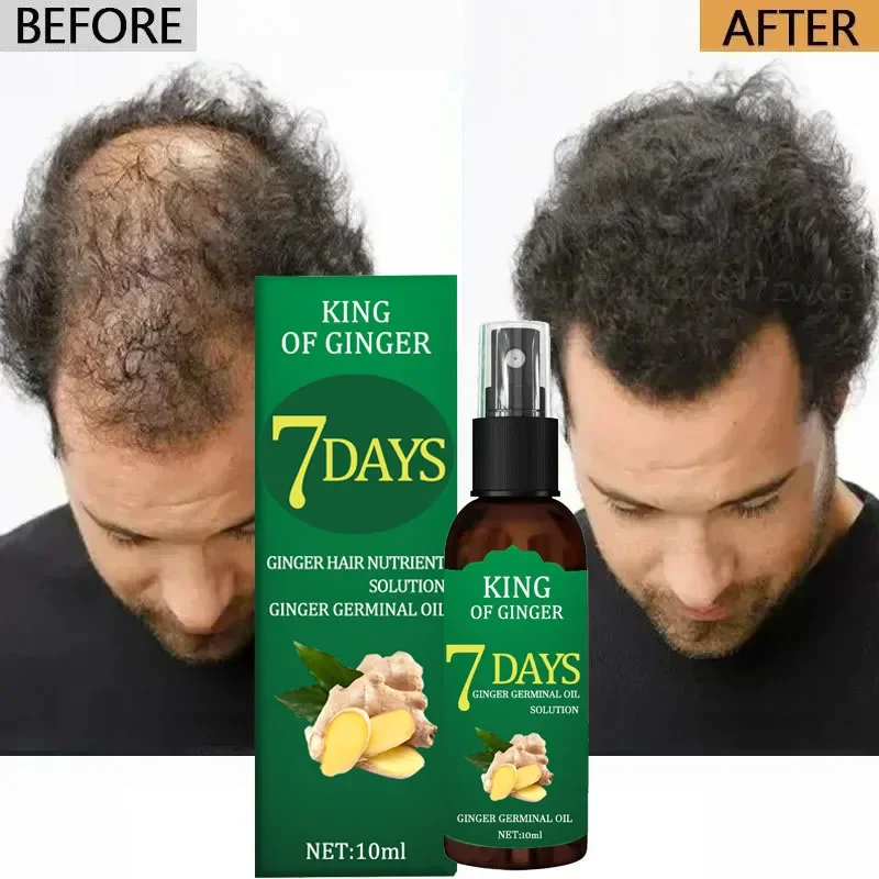 

Effective Rapid Repair Fast Baldness Hair Postpartum Hair Loss Follicles Hereditary Hair Loss Care Solution