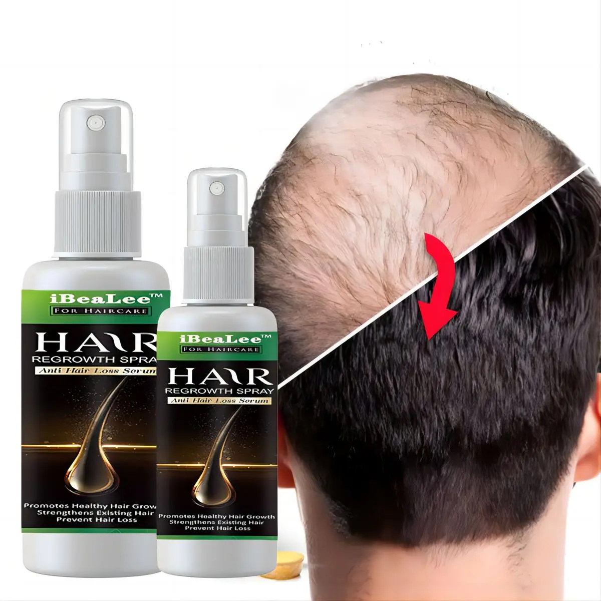 7DAYS Male and Female Ginger Hair Growth Spray Natural Anti Hair Loss Products Rapid Growth Essence To Prevent Hair